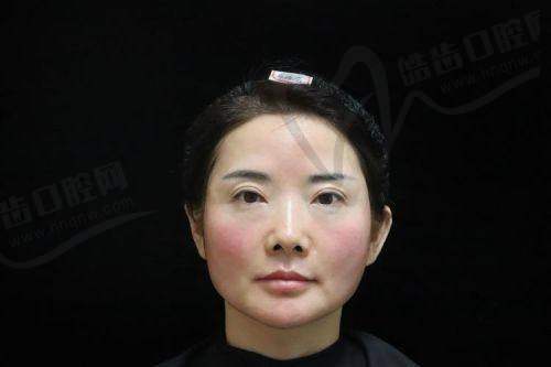 侯智群医生技术优势