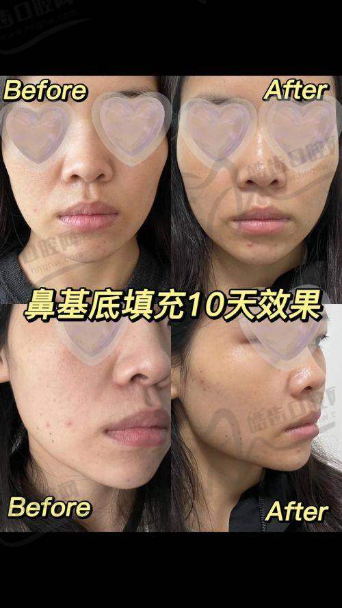 王琛医生预约挂号