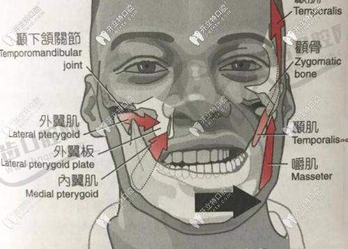 香港人揀植牙診所必睇3大關鍵（附避坑指南）