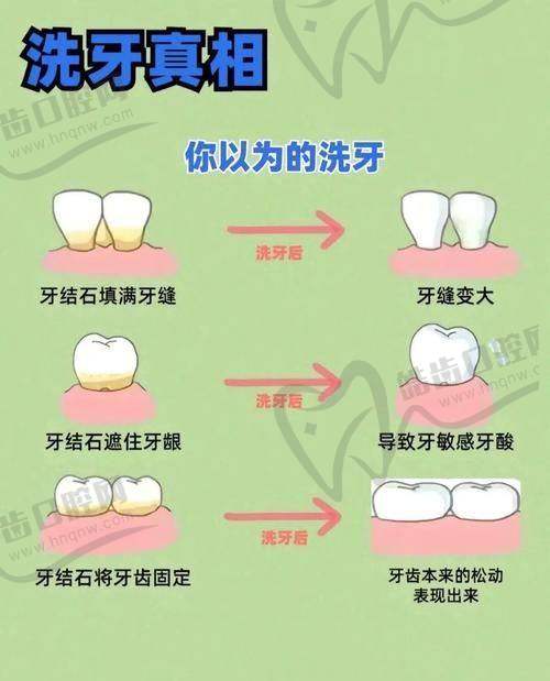 香港看牙醫多少錢？2025私立诊所收費表大公開！