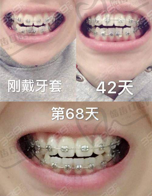 二、北京张栋梁骨性正畸医院地址汇总（含多个院区）