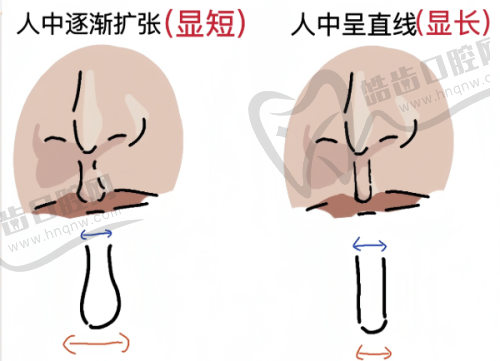 歌莉兰紧缩针产品缺点考量其好用程度