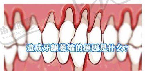 理性提醒：苹果肌复位术不是“越贵越好”，适合自己才是王道