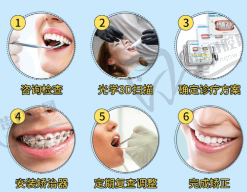 做苹果肌复位术需要多少钱？不同医生技术差异如何影响价格