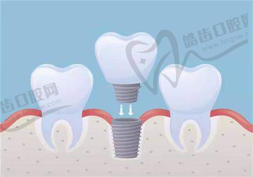 深圳佰仕口腔连锁（罗湖分院）特色项目及技术优势