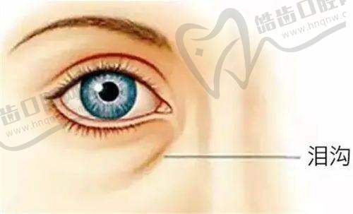 歌莉兰紧缩针产品优势凸显其好用之处