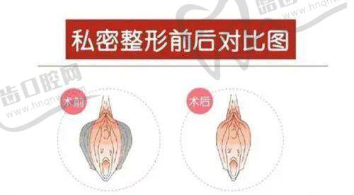 拉萨爱思特医疗美容医院真人口碑评价怎么样？