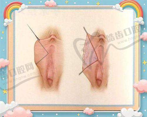 深圳怡康医院(私密整形中 心)地址电话营业时间