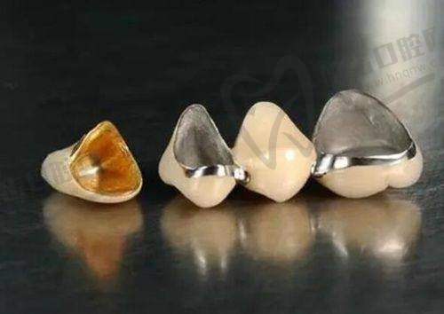 六、西宁博恩口腔门诊部价格表:(仅供参考)