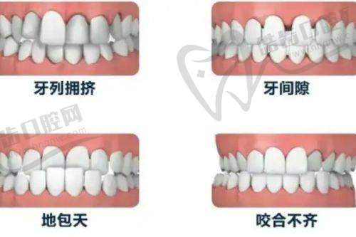 珠海瑞尔口腔医院诊疗项目