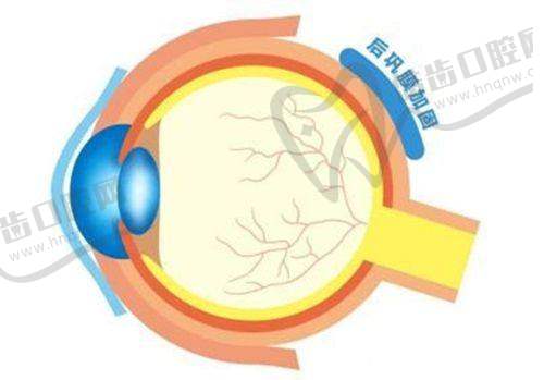 上海做近视眼手术的医院——上海普瑞眼科医院