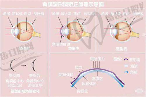 上海普瑞眼科医院于志强医生