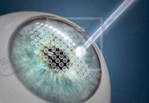 上海做近视眼手术的医院——上海何氏眼科医院