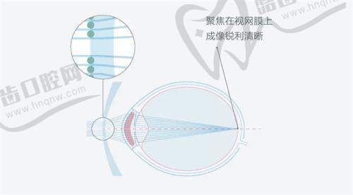 上海眼科医院刘瑜医生