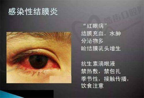 上海何氏眼科医院赵立全医生