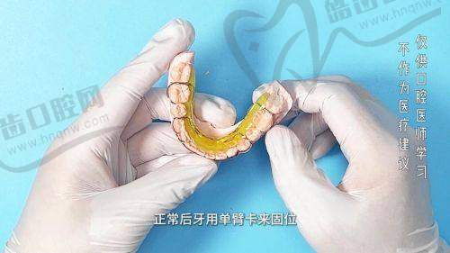 【深圳格伦菲尔口腔收费标准及价格目录】2025新版价目表！种一颗牙多少钱？1880元|矫正8800起，17家分院透明可医保