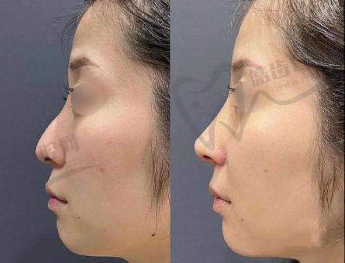 张恒术在重庆一附院坐诊：擅长领域