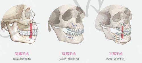 西 南医院治疗疤痕怎么样?——疤痕修复方法及成效