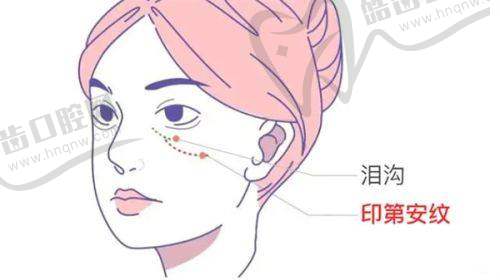 男士镶珠手术骗局?男士埋珠手术非骗局费用1000起|手术费用的影响因素