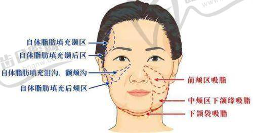 杭州蒋铮铮怎么样?艺星坐诊/注射技术优势/真实口碑解析