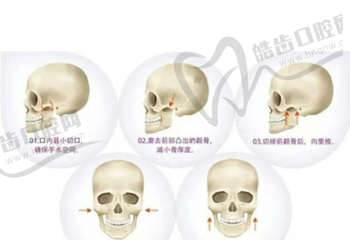 李花停医生的技术优势与价格关联