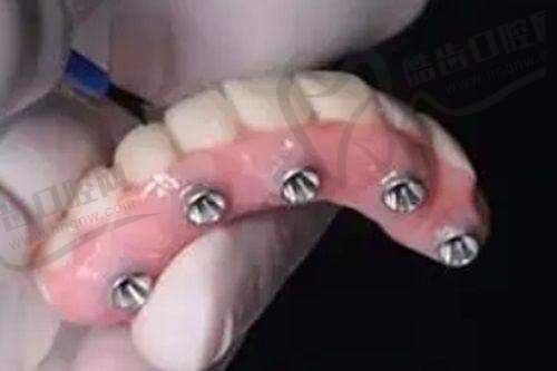 常德好大夫口腔医院靠谱吗？正规资质、特色技术与优质服务全揭秘！ 