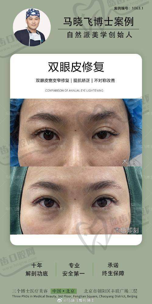哈尔滨诺嬄美整形美容医院项目特色