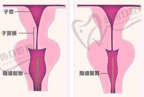 深圳婳美整形王悦琳医生预约挂号