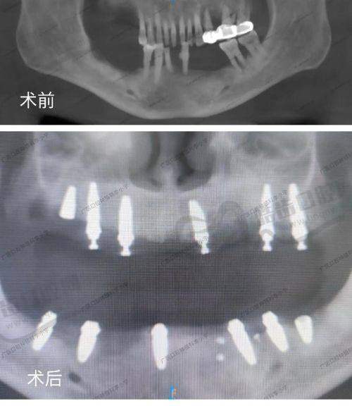 徐州中牙口腔医院地址电话