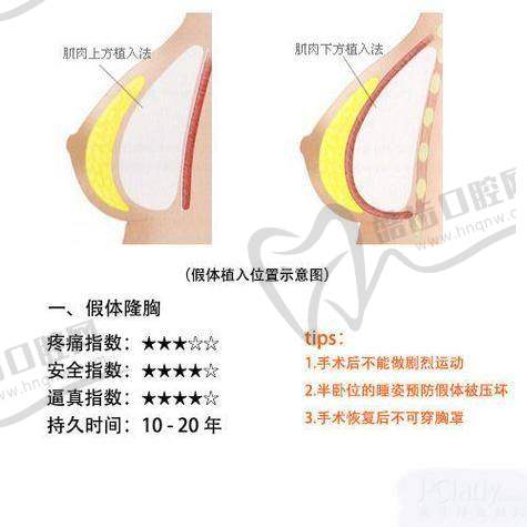 鲁树荣医生四川坐诊医院曝光!自体脂肪隆胸、馒化脸修复技术超厉害