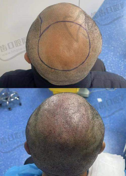 祁强医生预约挂号