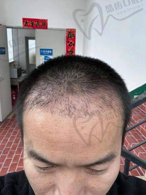 黄小飞医生坐诊医院
