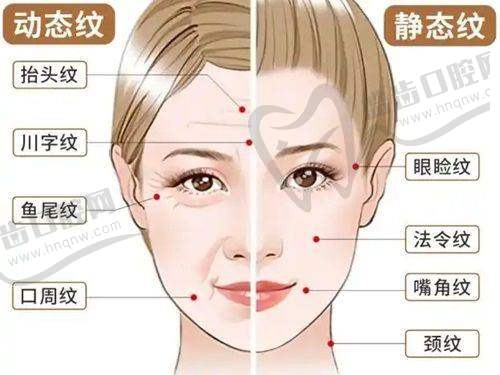 1. 溫州面部填充一般多少錢？價格表一覽