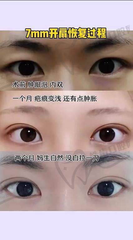上海刘平医生：20多年坚守铸就的眼鼻修复“安心之选”