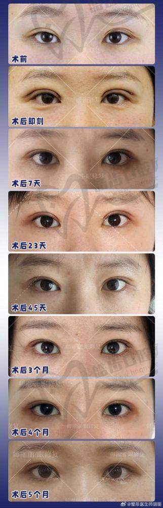 上海刘平医生20多年整形经验：从医学高材生到眼鼻修复具有影响力的沉淀之路