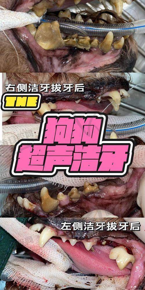 北京龈下刮治医院价格对比——北京中诺口腔