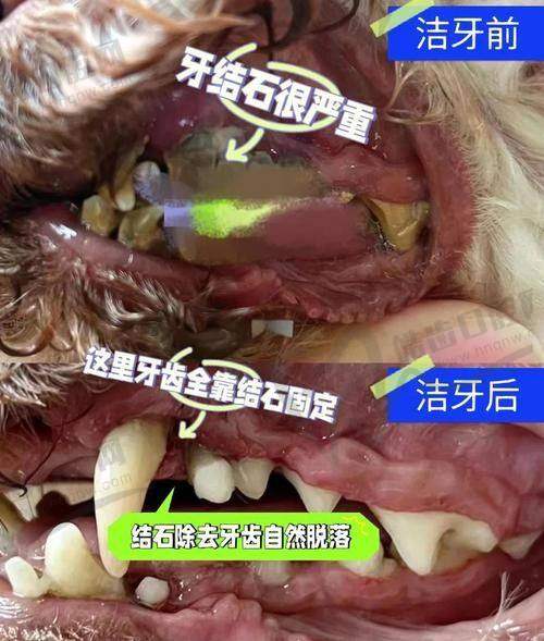 北京龈下刮治医院价格对比——北京诚欣瓒口腔
