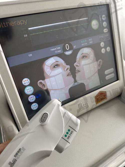 做超声炮十天后成效主要来自哪些方面呢？