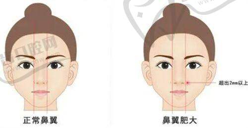 西安腺壁整形崔鑫医生之资质认证