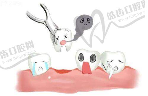 广州牙德堡口腔医院种植牙之医生团队