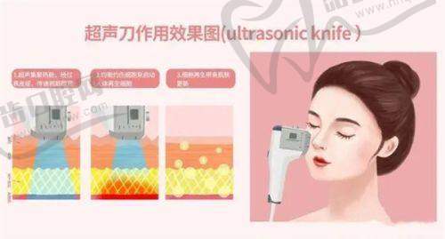 直击光微提升是什么？操作后必知的禁忌