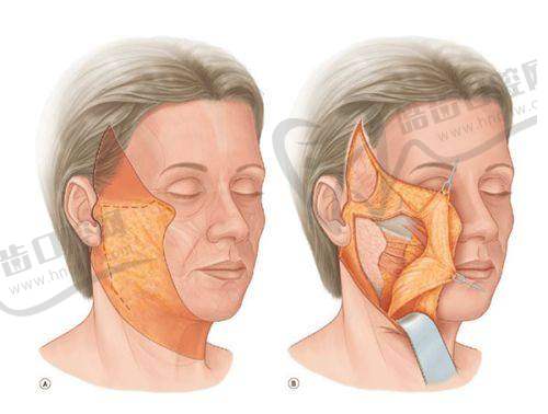 西安腺壁整形崔鑫怎么约之确认提交预约