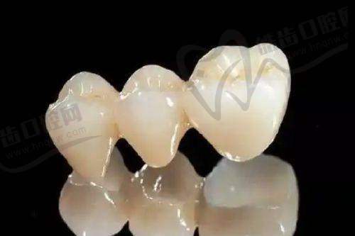 广州牙德堡全口BPS吸附性义齿1.2万元起，啃排骨都不掉！夜诊至21点超贴心