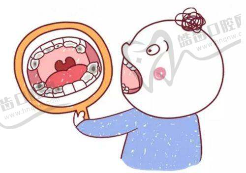 广州牙德堡口腔儿童乳牙拔除99元起，无痛操作让宝宝轻松告别乳牙期