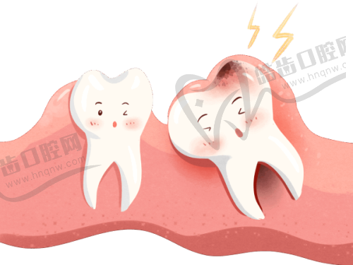 广州牙德堡口腔398元起深度洁牙套餐 超声波+喷砂抛光 告别烟渍茶渍