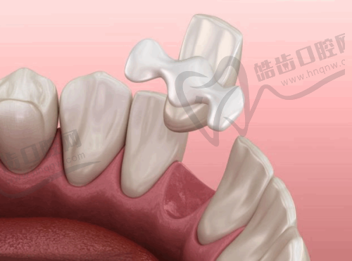 3、石家庄全博口腔（慢城分院）特色项目：