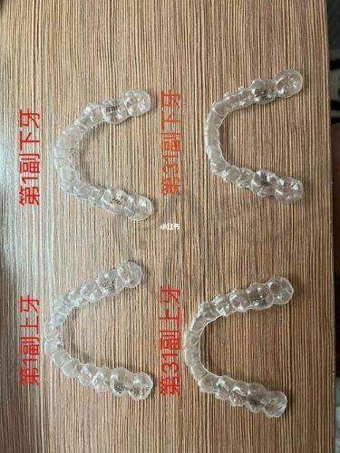 广州牙德堡口腔低位智齿拔除480元起，技术强口碑好，越秀区拔牙首选！