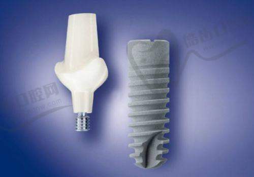 广州牙德堡口腔E-MAX铸瓷贴面7360元起，超薄0.2mm不磨牙，黄牙秒变明星牙