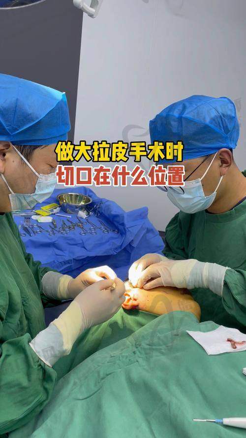 眭云鹏做拉皮怎么样？