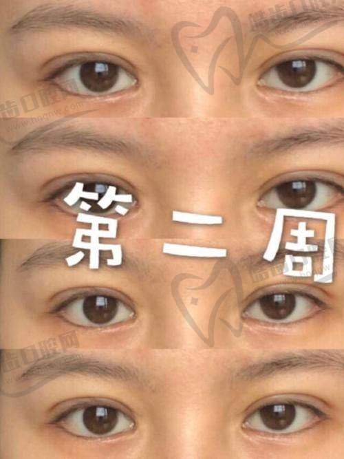 <span style=